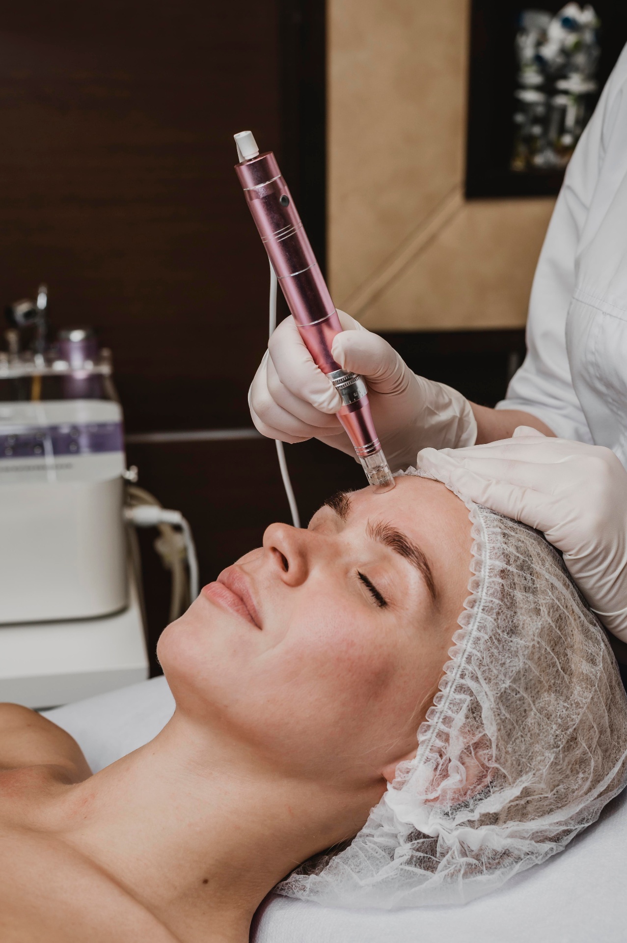 PDRN microneedling-behandling i ansiktet